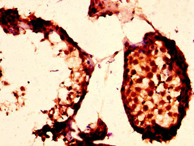 PLTP Antibody