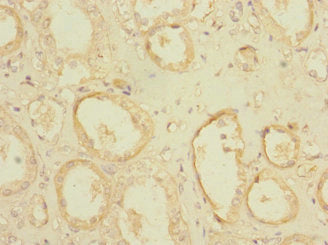 POGK Antibody
