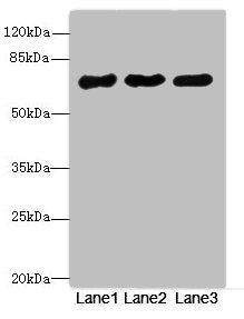 PPM1D Antibody
