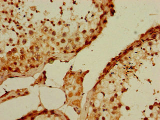 PQBP1 Antibody