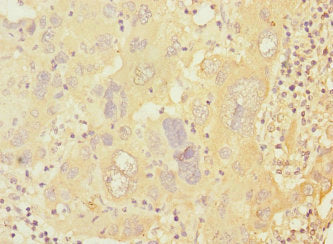PRKAR1B Antibody