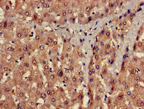 PROC Antibody