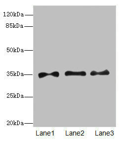 PRPS1 Antibody