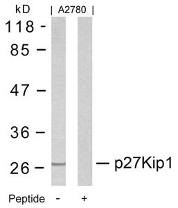 CDKN1B (Ab-10) Antibody