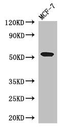 PSEN1 Antibody