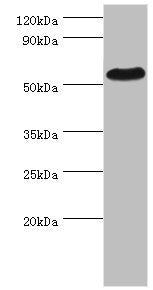 PSEN1 Antibody