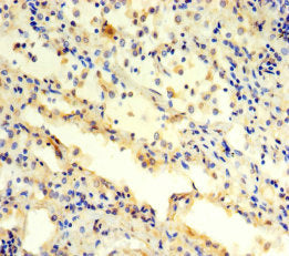 PSMC3 Antibody