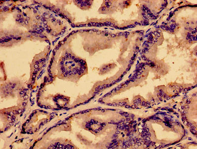 PTGDS Antibody