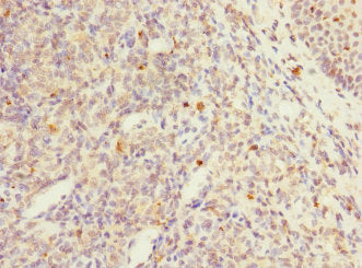 PTPN7 Antibody