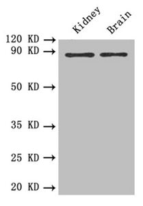 Rabbit anti-human PTPRE Antibody