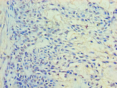 RAB11A Antibody