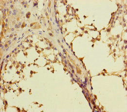 RAB27B Antibody