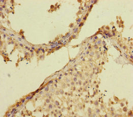 RAB27B Antibody