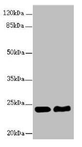 RAB5B Antibody