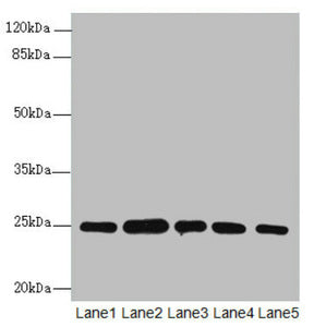 RAB5B Antibody