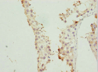 RAB5C Antibody
