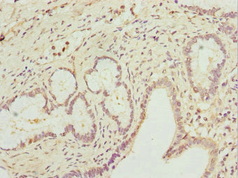 RAB5C Antibody