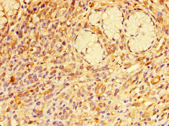 RAB7A Antibody
