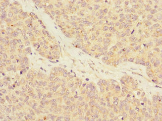 RASA4 Antibody