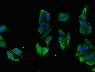 RASGRP1 Antibody