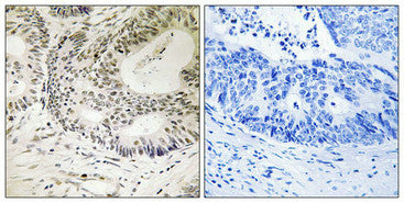 Phospho-TP53BP1 (Ser25) Antibody