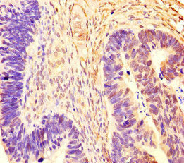 RCOR1 Antibody