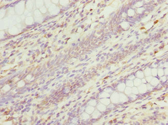 RGS5 Antibody