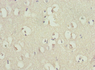 RGS7 Antibody