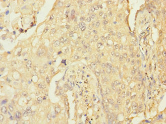 RGS9 Antibody