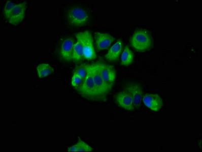 RHOD Antibody