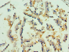 RIPK2 Antibody