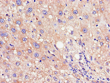 RND3 Antibody