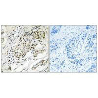 CDYL2 Antibody