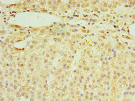 RNF212 Antibody