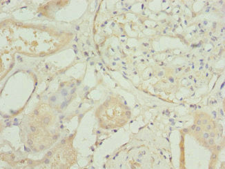 RP2 Antibody