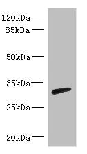 RPIA Antibody