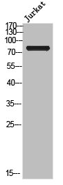 Cleaved-NOTCH2 (A1734) Antibody