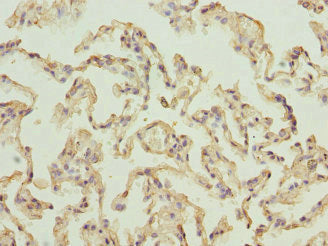 RPLP2 Antibody
