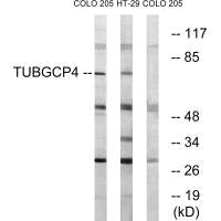 TUBGCP4 Antibody