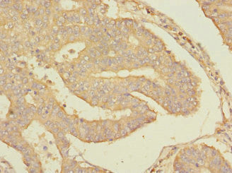 RPS27 Antibody