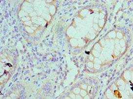 RPS4X Antibody