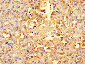 RPS6 Antibody