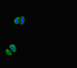 RPS6KB1 Antibody