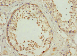 RPS6KL1 Antibody