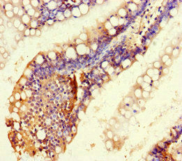 RTEL1 Antibody