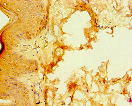 S100A3 Antibody