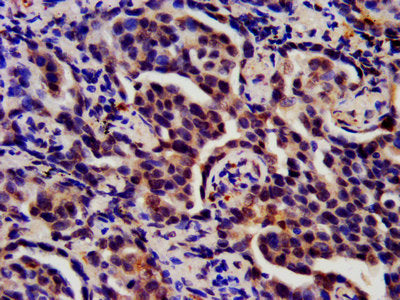 S100A8 Antibody