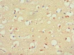 S100B Antibody
