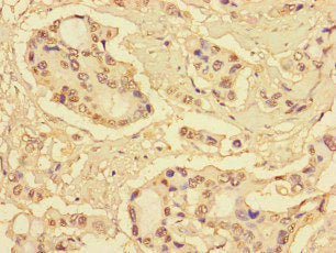S100P Antibody