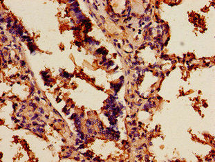 SCD Antibody